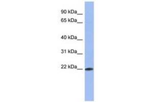 Image no. 1 for anti-RNA Binding Motif Protein 38 (RBM38) (C-Term) antibody (ABIN6743016) (RBM38 抗体  (C-Term))