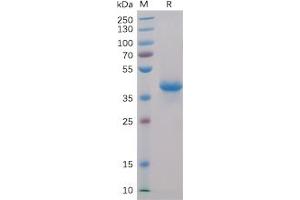 Human BCMA, hFc-His Tag on SDS-PAGE under reducing condition. (BCMA Protein (Fc-His Tag))