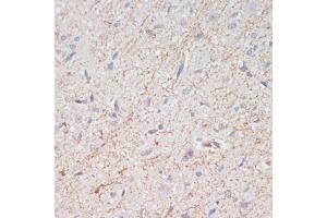 Immunohistochemistry (IHC) image for anti-Solute Carrier Family 6 (Neurotransmitter Transporter, Dopamine), Member 3 (SLC6A3) (C-Term) antibody (ABIN7270474)