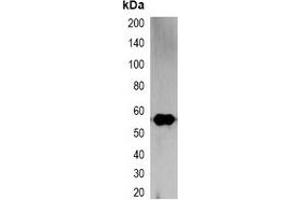 Western blot analysis of over-expressed RFP-tagged protein in 293T cell lysate.