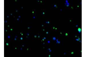 Immunofluorescence staining of 293F transfected cells with ABIN7193151 at 1:100, counter-stained with DAPI. (HA-Tag 抗体)