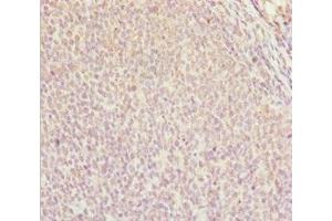 Immunohistochemistry of paraffin-embedded human tonsil tissue using ABIN7144963 at dilution of 1:100 (DDX11 抗体  (AA 1-220))