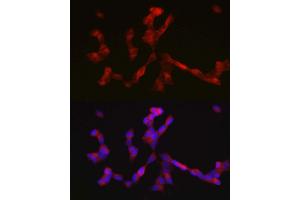 Immunofluorescence analysis of SH-SY5Y cells using ALK antibody  at dilution of 1:200. (ALK 抗体  (AA 19-300))