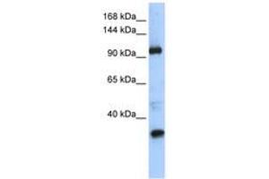 Image no. 1 for anti-Terminal Uridylyl Transferase 1, U6 SnRNA-Specific (TUT1) (AA 829-878) antibody (ABIN6740612) (TUT1 抗体  (AA 829-878))