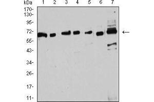 Estrogen Receptor alpha 抗体  (AA 2-185)