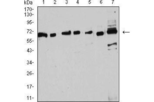 Estrogen Receptor alpha 抗体  (AA 2-185)