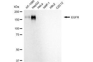 Western blotting analysis using EGFR antibody (ABIN7798480). (Recombinant EGFR 抗体)