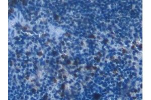 Detection of RSPO1 in Mouse Spleen Tissue using Polyclonal Antibody to R-Spondin 1 (RSPO1)