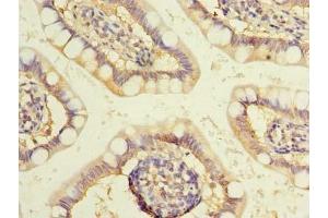 Immunohistochemistry of paraffin-embedded human small intestine tissue using ABIN7175757 at dilution of 1:100 (WDR49 抗体  (AA 251-500))