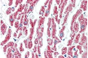 Human Heart (formalin-fixed, paraffin-embedded) stained with ACO2 antibody ABIN462115 followed by biotinylated goat anti-rabbit IgG secondary antibody ABIN481713, alkaline phosphatase-streptavidin and chromogen. (ACO2 抗体  (AA 438-467))