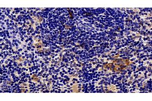 Immunohistochemistry (IHC) image for anti-Sequestosome 1 (SQSTM1) (AA 136-400) antibody (ABIN7435412)