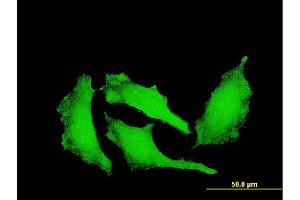 Immunofluorescence of monoclonal antibody to ATP9A on HeLa cell.