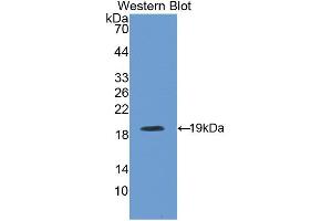 Western blot analysis of the recombinant protein. (CFP 抗体  (AA 54-217))