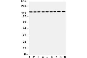Western Blotting (WB) image for anti-Transient Receptor Potential Cation Channel, Subfamily C, Member 3 (TRPC3) (AA 836-851) antibody (ABIN3029230)