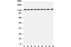 Western blot testing of TRPC3 antibody and Lane 1:  rat liver;  2: (r) lung;  3: (r) intestine;  4: (r) ovary;  5: human U87;  6: (h) A549;  7: (h) COLO320;  8: (h) SW620;  9: (h) HeLa (TRPC3 抗体  (AA 836-851))