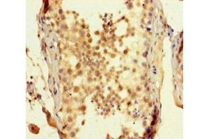 Immunohistochemistry of paraffin-embedded human testis tissue using ABIN7170512 at dilution of 1:100 (SPATA16 抗体  (AA 238-475))