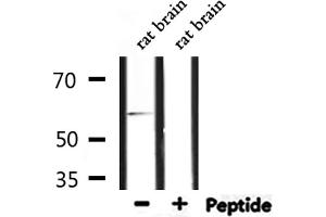 Western blot analysis of extracts from rat brain, using TF2H1 Antibody. (GTF2H1 抗体  (N-Term))
