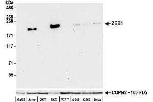 Western Blotting (WB) image for anti-Zinc Finger E-Box Binding Homeobox 1 (ZEB1) (AA 1074-1124) antibody (ABIN7453320) (Recombinant ZEB1 抗体  (AA 1074-1124))
