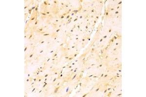 Immunohistochemistry (Paraffin-embedded Sections) (IHC (p)) image for anti-serine/arginine-Rich Splicing Factor 1 (SRSF1) (pSer1) antibody (ABIN3022320)