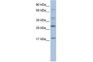 WB Suggested Anti-PYCARD Antibody Titration:  2. (PYCARD 抗体  (Middle Region))