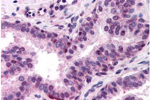 Human Prostate (formalin-fixed, paraffin-embedded) stained with NFYA antibody ABIN218318 at 1:400 followed by biotinylated goat anti-rabbit IgG secondary antibody ABIN481713, alkaline phosphatase-streptavidin and chromogen. (NFYA 抗体  (N-Term))