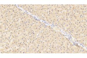 Detection of GRN in Human Liver Tissue using Polyclonal Antibody to Granulin (GRN) (Granulin 抗体  (AA 361-585))