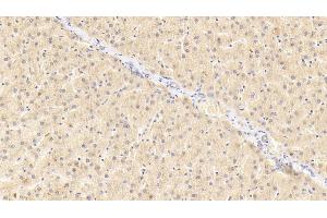 Detection of GRN in Human Liver Tissue using Polyclonal Antibody to Granulin (GRN) (Granulin 抗体  (AA 361-585))