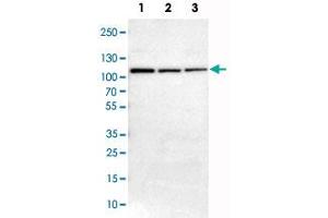 Western Blot analysis of Lane 1: NIH-3T3 cell lysate (mouse embryonic fibroblast cells), Lane 2: NBT-II cell lysate (Wistar rat bladder tumor cells) and Lane 3: PC12 cell lysate (pheochromocytoma of rat adrenal medulla) with AK7 polyclonal antibody . (Adenylate Kinase 7 抗体)