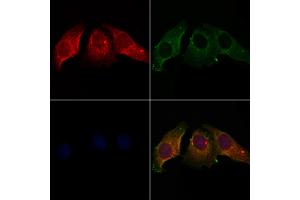 ABIN7094110 and ABIN7098154 staining Hela cells by IF/ICC. (CALU 抗体  (Internal Region))