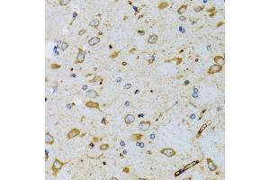 Immunohistochemistry (IHC) image for anti-Signal Recognition Particle 19kDa (SRP19) (AA 1-144) antibody (ABIN6148450)