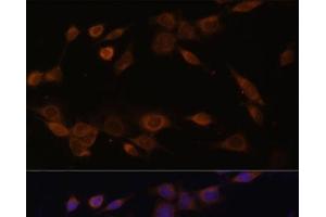 Immunofluorescence analysis of NIH-3T3 cells using POR Polyclonal Antibody at dilution of 1:100 (40x lens). (POR 抗体)