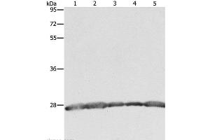 Western Blot analysis of Hela, 293T and MCF7 cell, Human fetal brain tissue and Jurkat cell using PRDX3 Polyclonal Antibody at dilution of 1:800 (Peroxiredoxin 3 抗体)