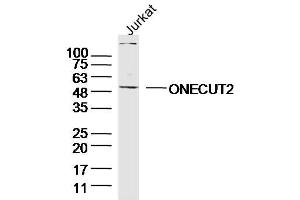 Jurkay lysates probed with ONECUT2 Polyclonal Antibody, Unconjugated  at 1:300 overnight at 4˚C. (ONECUT2 抗体  (AA 401-504))