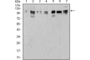 Western Blotting (WB) image for anti-Unc-51 Like Kinase 2 (ULK2) (AA 1-155) antibody (ABIN5882566) (ULK2 抗体  (AA 1-155))