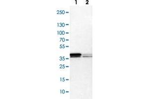 Western blot analysis of Lane 1: NIH-3T3 cell lysate (Mouse embryonic fibroblast cells), Lane 2: NBT-II cell lysate (Rat Wistar bladder tumour cells) with HNRNPA2B1 polyclonal antibody . (HNRNPA2B1 抗体)