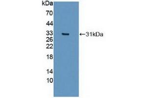 Detection of Recombinant IREB2, Human using Polyclonal Antibody to Iron Responsive Element Binding Protein 2 (IREB2) (IREB2 抗体  (AA 39-281))