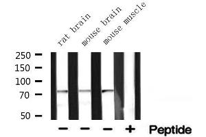 Western blot analysis of extracts of various tissue ,using ACSA antibody (ACSS2 抗体  (N-Term))