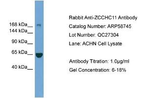WB Suggested Anti-ZCCHC11  Antibody Titration: 0. (ZCCHC11 抗体  (Middle Region))