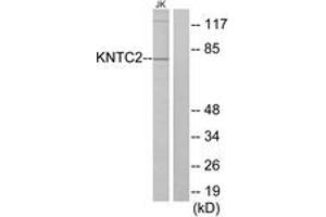 Western blot analysis of extracts from Jurkat cells, using KNTC2 Antibody.
