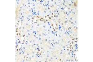 Immunohistochemistry of paraffin-embedded mouse kidney using DDX39A antibody (ABIN6131590, ABIN6139489, ABIN6139491 and ABIN6223963) at dilution of 1:100 (40x lens).