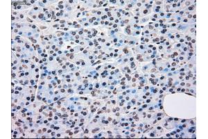 Immunohistochemical staining of paraffin-embedded Kidney tissue using anti-BRAFmouse monoclonal antibody. (BRAF 抗体)