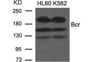 Western blot analysis of extracts from HL60 and K562 cells using Bcr(Ab-177) Antibody. (BCR 抗体)