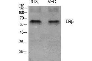 Western Blot (WB) analysis of specific cells using ERbeta Polyclonal Antibody. (ESR2 抗体  (Ser367))