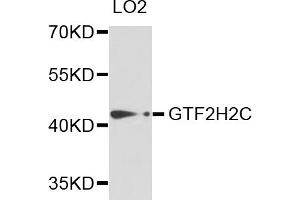 Western blot analysis of extracts of LO2 cells, using GTF2H2C antibody.