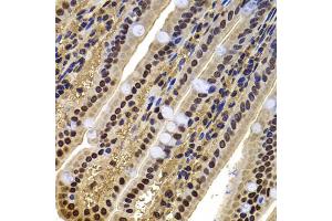 Immunohistochemistry of paraffin-embedded mouse jejunum using ACTL6B antibody (ABIN5974275) at dilution of 1/100 (40x lens). (Actin-Like 6B 抗体)
