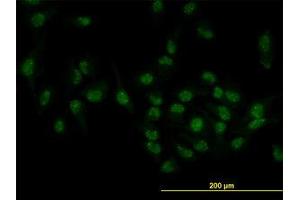 Image no. 3 for anti-Target of EGR1, Member 1 (Nuclear) (TOE1) (AA 1-511) antibody (ABIN599319) (TOE1 抗体  (AA 1-511))