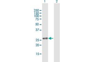 Western Blot analysis of C11orf17 expression in transfected 293T cell line by C11orf17 MaxPab polyclonal antibody. (AKIP1 抗体  (AA 1-210))