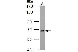 WB Image PCK2 antibody [C1C2], Internal detects PCK2 protein by Western blot analysis. (PEPCK 抗体)