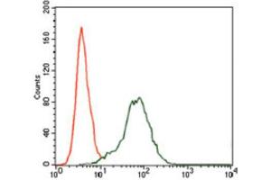 Immunohistochemical analysis of paraffin-embedded bladder cancer tissues using Insulin Like Growth Factor 2 (IGF2) antibody with DAB staining. (IGF2 抗体  (AA 25-180))