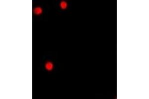 Immunofluorescent analysis of AEBP2 staining in A549 cells. (AEBP2 抗体)